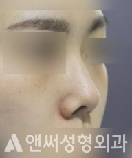 Answer Plastic Surgery case 216: Before