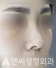 Answer Plastic Surgery case 216: After