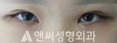 Answer Plastic Surgery case 214: Before