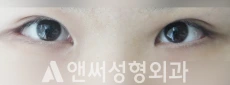 Answer Plastic Surgery case 214: After