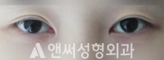 Answer Plastic Surgery case 213: Before