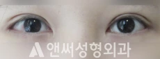 Answer Plastic Surgery case 213: After