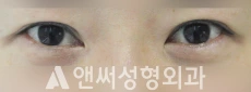 Answer Plastic Surgery case 212: Before