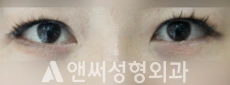 Answer Plastic Surgery case 212: After