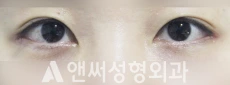 Answer Plastic Surgery case 211: After