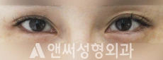 Answer Plastic Surgery case 210: Before