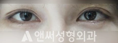 Answer Plastic Surgery case 210: After