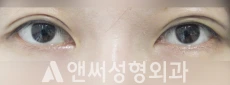 Answer Plastic Surgery case 209: After