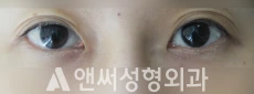 Answer Plastic Surgery case 208: Before
