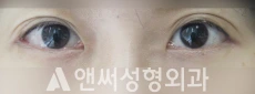 Answer Plastic Surgery case 208: After