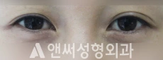 Answer Plastic Surgery case 207: Before
