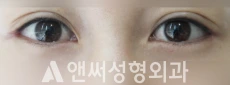 Answer Plastic Surgery case 207: After