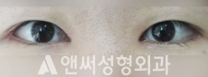 Answer Plastic Surgery case 206: After