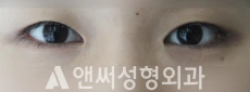 Answer Plastic Surgery case 205: Before