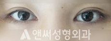 Answer Plastic Surgery case 205: After