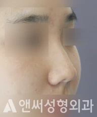 Answer Plastic Surgery case 204: Before