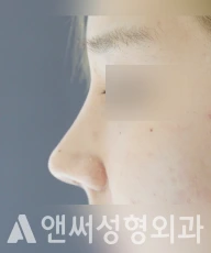 Answer Plastic Surgery case 203: After