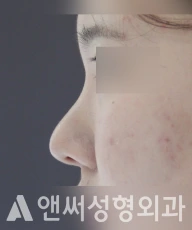 Answer Plastic Surgery case 202: Before