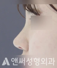Answer Plastic Surgery case 202: After