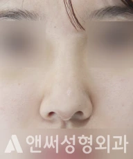 Answer Plastic Surgery case 201: After