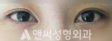 Answer Plastic Surgery case 200: Before