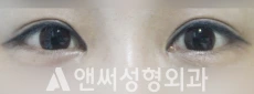 Answer Plastic Surgery case 200: After