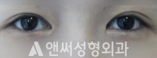 Answer Plastic Surgery case 199: Before