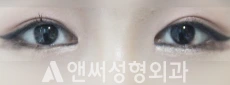 Answer Plastic Surgery case 199: After