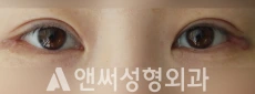 Answer Plastic Surgery case 198: Before