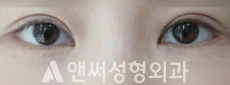 Answer Plastic Surgery case 198: After