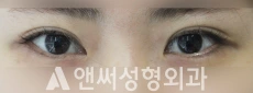 Answer Plastic Surgery case 197: Before