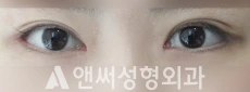 Answer Plastic Surgery case 197: After