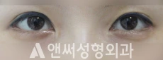 Answer Plastic Surgery case 196: After