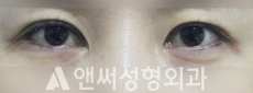 Answer Plastic Surgery case 195: Before