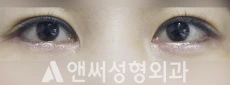Answer Plastic Surgery case 195: After