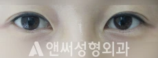 Answer Plastic Surgery case 194: Before
