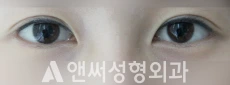 Answer Plastic Surgery case 194: After