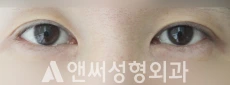 Answer Plastic Surgery case 193: Before