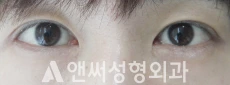 Answer Plastic Surgery case 193: After