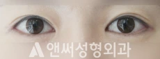 Answer Plastic Surgery case 144: After