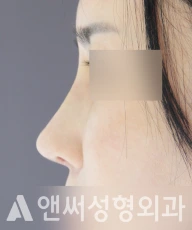 Answer Plastic Surgery case 143: After