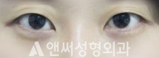 Answer Plastic Surgery case 141: Before