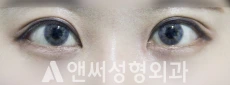 Answer Plastic Surgery case 141: After