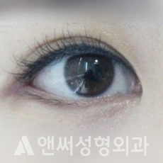 Answer Plastic Surgery case 140: After