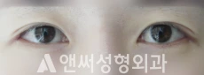 Answer Plastic Surgery case 139: After