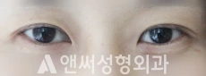 Answer Plastic Surgery case 138: Before