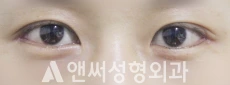 Answer Plastic Surgery case 138: After