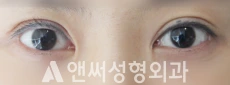 Answer Plastic Surgery case 137: Before