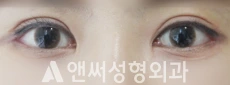 Answer Plastic Surgery case 137: After
