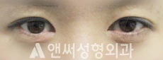 Answer Plastic Surgery case 136: Before